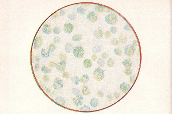 Ретикулоциты, окрашенные бриллианткрезиловой синькой