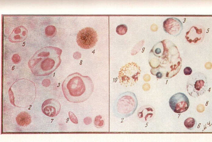 Клетки нормального ликвора