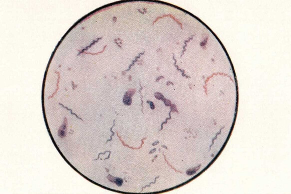 Спирохеты сифилиса. Окраска по Романовскому