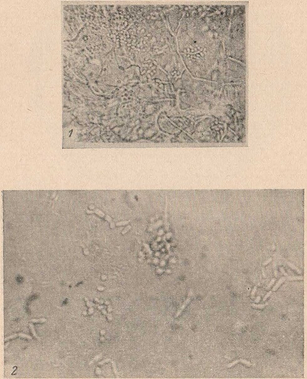 Микроскопическая картина кандидамикоза кожи