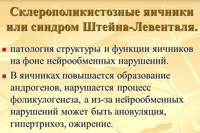 Что такое синдром Штейна-Левенталя