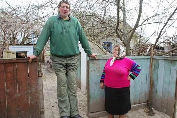Пример гипофизарного гигантизма