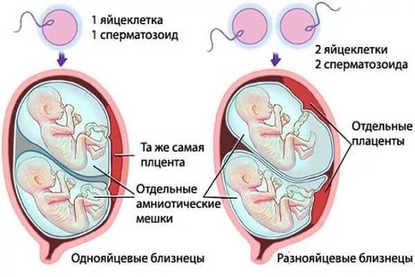 Принцип многоплодной беременности