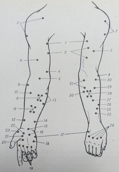 Двигательные точки на руке