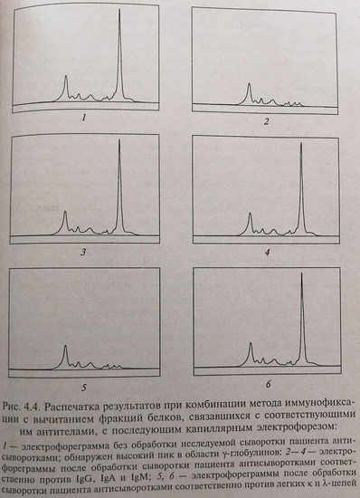 Распечатка результатов при комбинации метода иммунофиксации