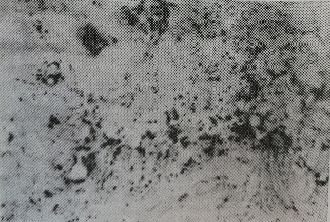 Интерстициальная ткань яичника крысы, подвергавшейся действию лазера