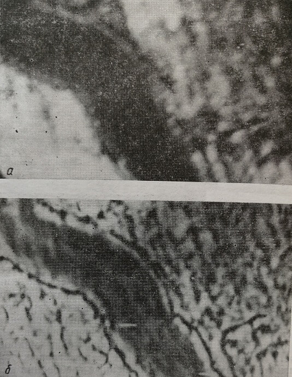 Изображение венулы лягушки, полученное с капилляроскопа ТМ-1