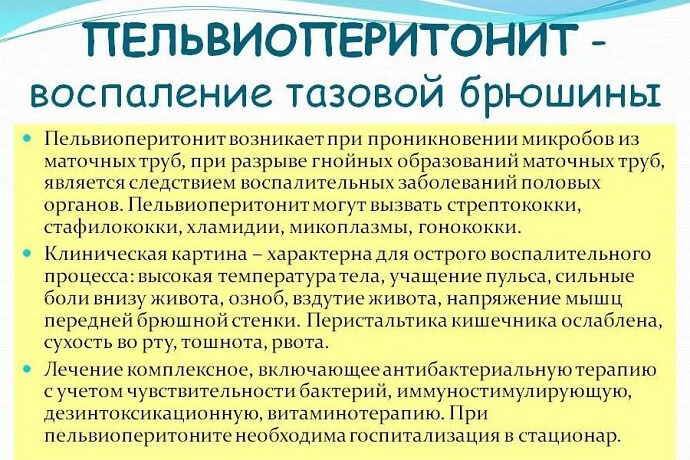 Что такое пельвиоперитонит