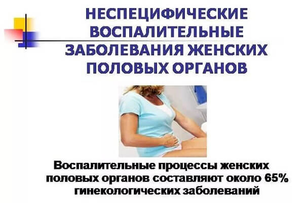 Неспецифические воспалительные заболевания женских половых органов