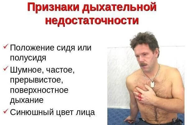 Признаки дыхательной недостаточности