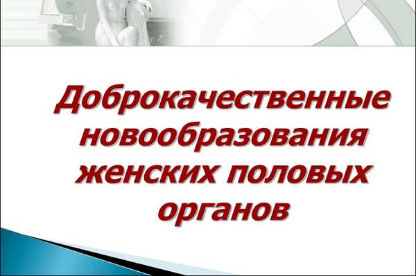 Доброкачественные новообразования женских половых органов