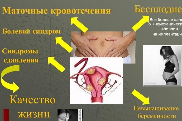 Болевой синдром в гинекологии