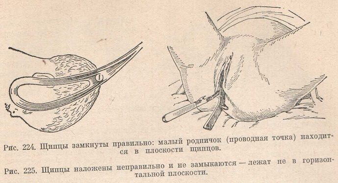 Щипцы замкнуты правильно