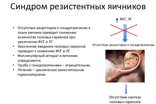 Что такое синдром резистентных яичников