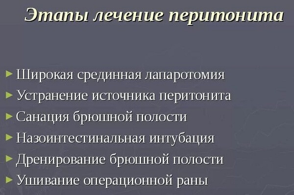 Этапы лечения перитонита