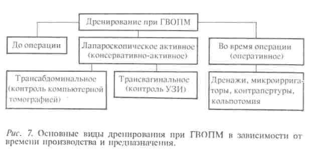 Виды дренирования при ГВОПМ в зависимости от времени производства