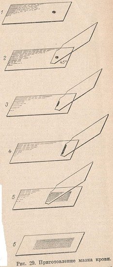 Приготовление мазка крови