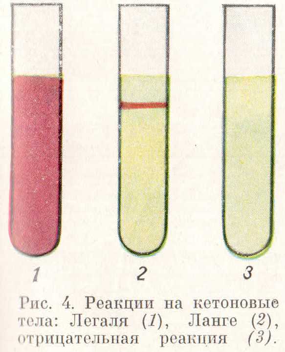 Кетонов тела