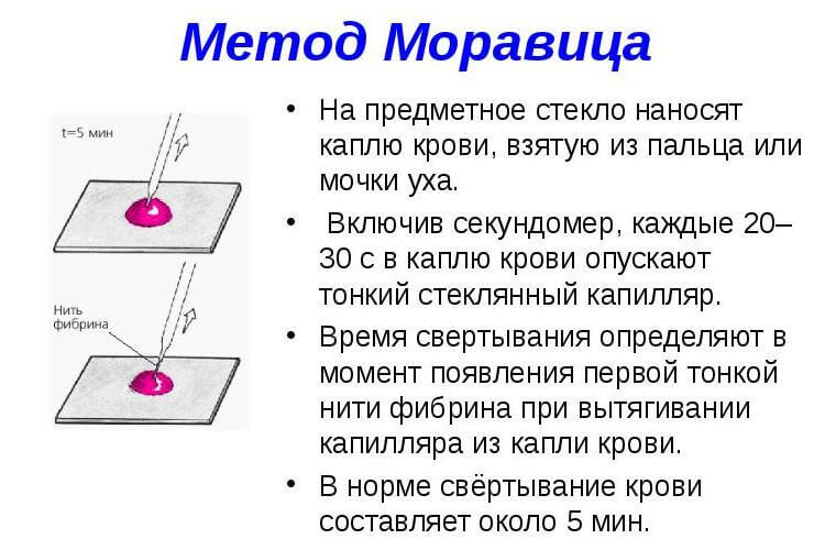 Сущность метода Моравица при определении времени свертывания крови