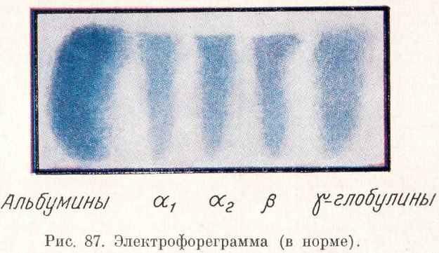 Электрофореграмма (в норме)