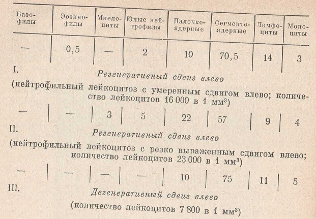 Таблица для расчетов лейкоцитарной формулы при сдвигах формулы влево