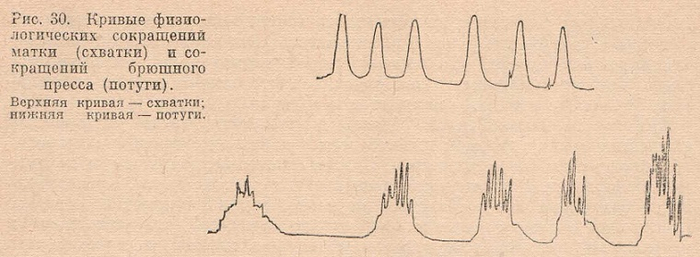 Кривые физиологических сокращений матки и брюшного пресса