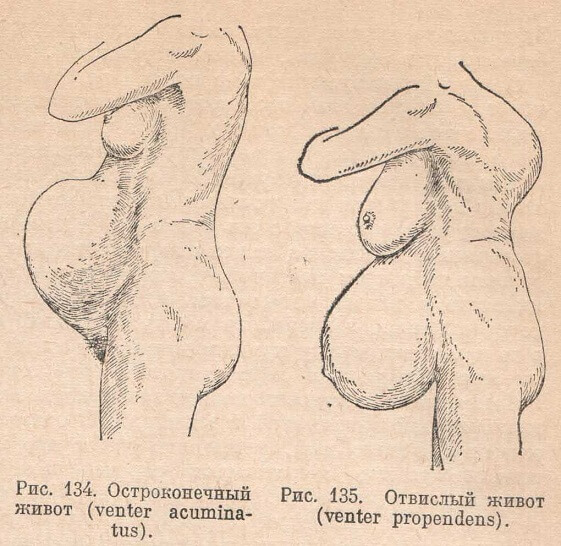 Остроконечный и отвислый живот