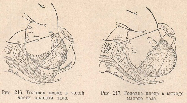 Размеры головки плода