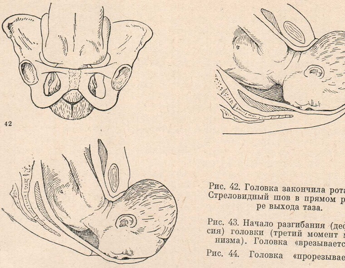 Ротации головки во время биомеханизма родов