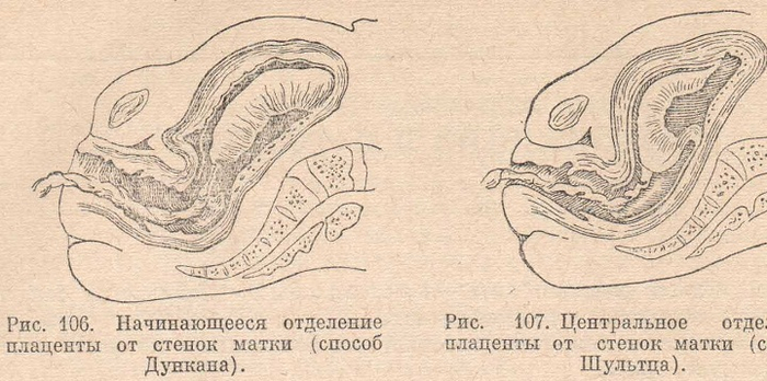 Способ Дункана и способ Шультца