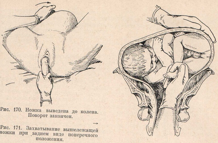 Ножка выведена до колена. Поворот закончен