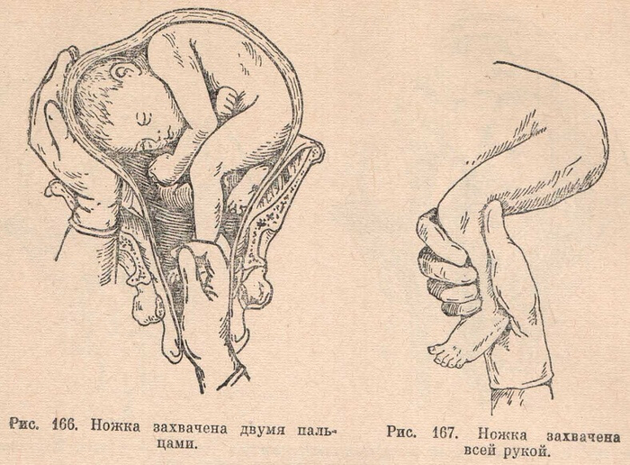 Ножка захвачена двумя пальцами и всей рукой